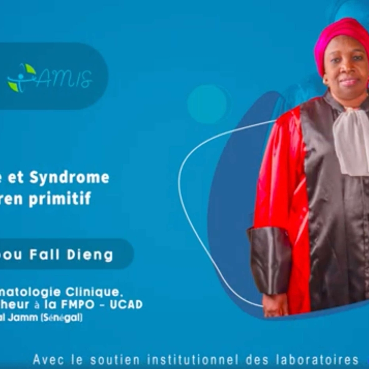 Lymphome et Syndrome de SJÖGREN primitif