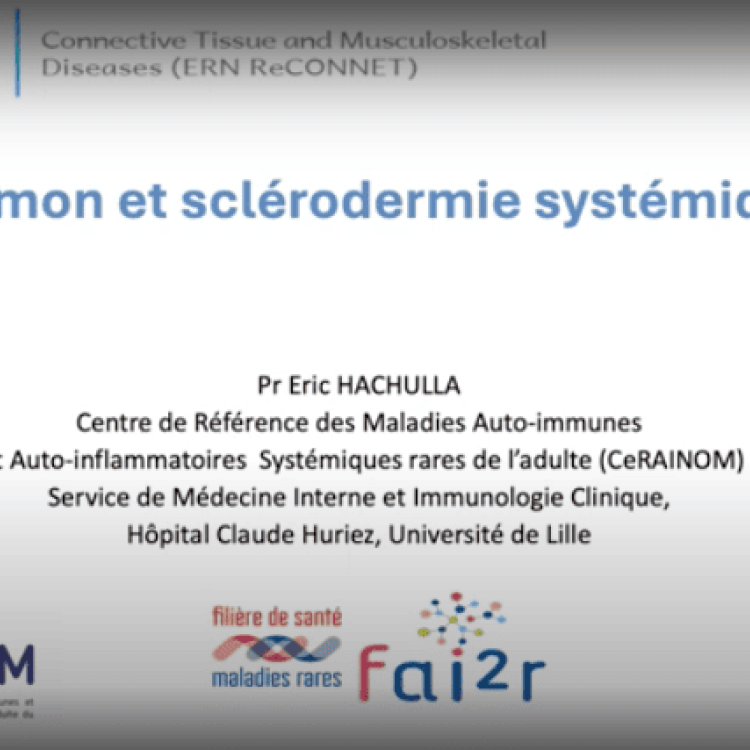 Pr Eric Hachulla : Poumon et Sclérodermie systémique